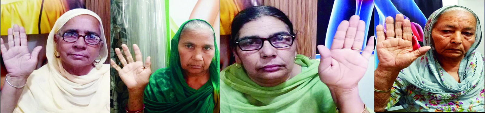 ਗੋਡਿਆਂ ਦੇ ਮਰੀਜ਼ ਨਰਾਇਣੀ ਆਰਥੋਕਿੱਟ ਨਾਲ ਹੋ ਰਹੇ ਹਨ ਠੀਕ : ਡਾ. ਸਿੱਧੂ