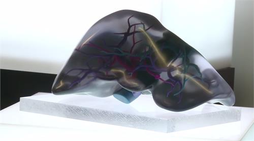 indian company develops 3d printed liver tissue