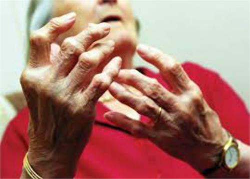 arthritis patient treatment homeopathy