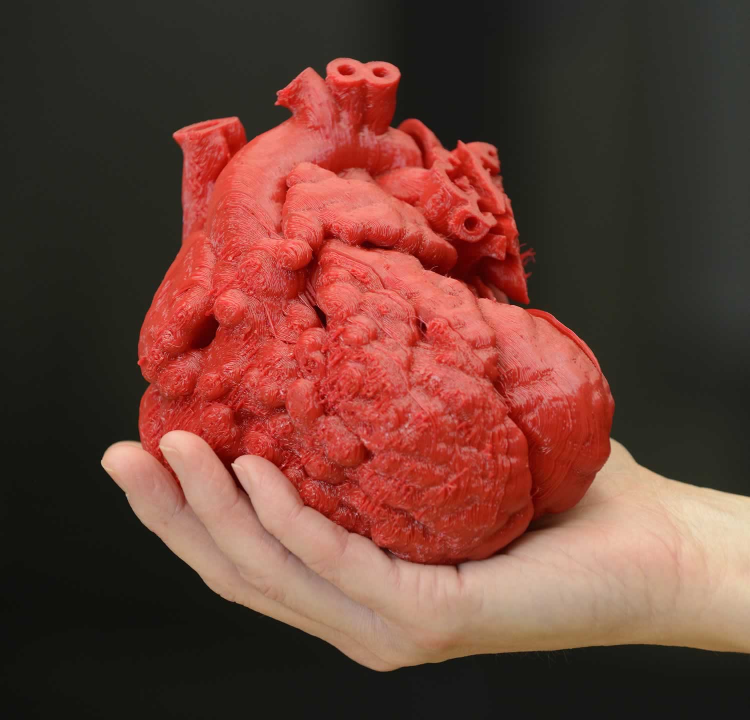 3d printer with a vessel used in diseases of the heart
