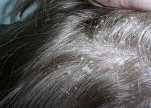 daindarapha sikri the problem of the causes and treatment