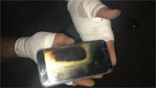 samsung galaxy s7 explodes in man s hand