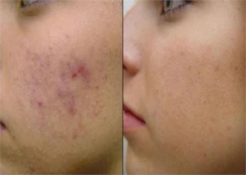 if you want to brand non stained face measures