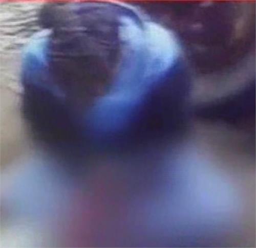 people caught robbing the bank robber fleeing cut hand