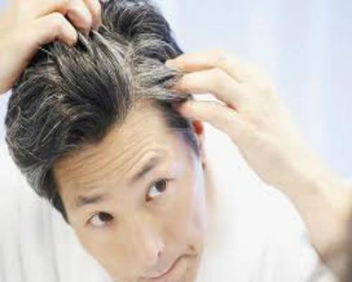 for grey hairs environment is not reponsible genes responsible
