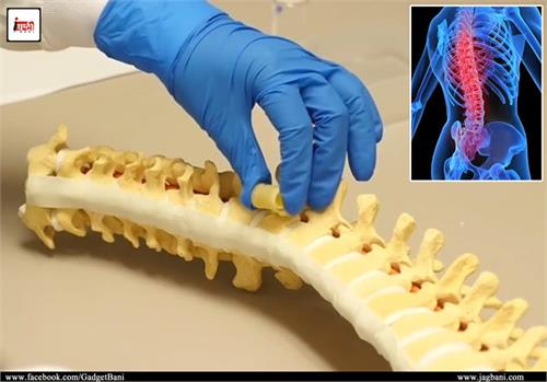 polymer sponge will repair to spinal cord