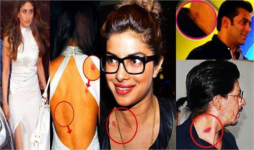 love bites of bollywood stars