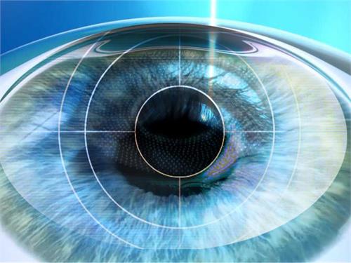 ibm and bausch  lomb creating new app for cataract surgeons