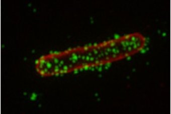 can take the place of antibiotics with the shape of the new stars paulimara