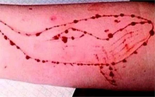 blue whale game  supreme court