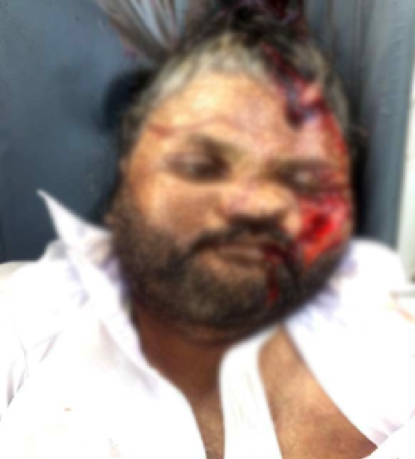 ਵੱਖ-ਵੱਖ ਹਾਦਸਿਆਂ ''ਚ 5 ਜ਼ਖਮੀ, 1 ਦੀ ਮੌਤ