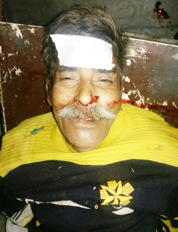 ਪੈਦਲ ਜਾ ਰਹੇ ਵਿਅਕਤੀ ਨੂੰ ਵਾਹਨ ਨੇ ਮਾਰੀ ਟੱਕਰ, ਮੌਤ