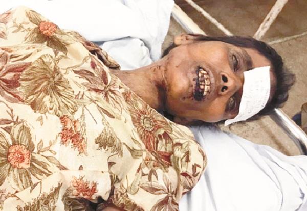 unidentified woman dies during treatment at hospital