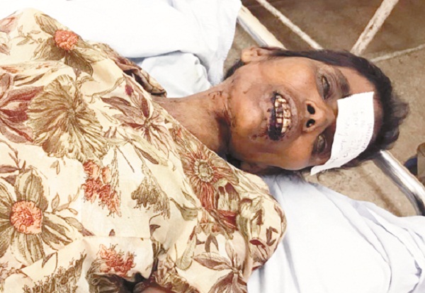 ਅਣਪਛਾਤੀ ਔਰਤ ਦੀ ਹਸਪਤਾਲ ''ਚ ਇਲਾਜ ਦੌਰਾਨ ਮੌਤ