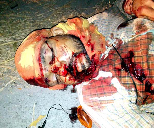 ਅਣਪਛਾਤੇ ਵਾਹਨ ਨਾਲ ਟਕਰਾਉਣ ਕਾਰਨ ਮੌਤ