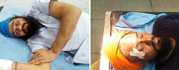 two injured in bus collision in tata safari