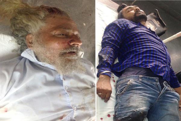 father and son injured due to a car accident