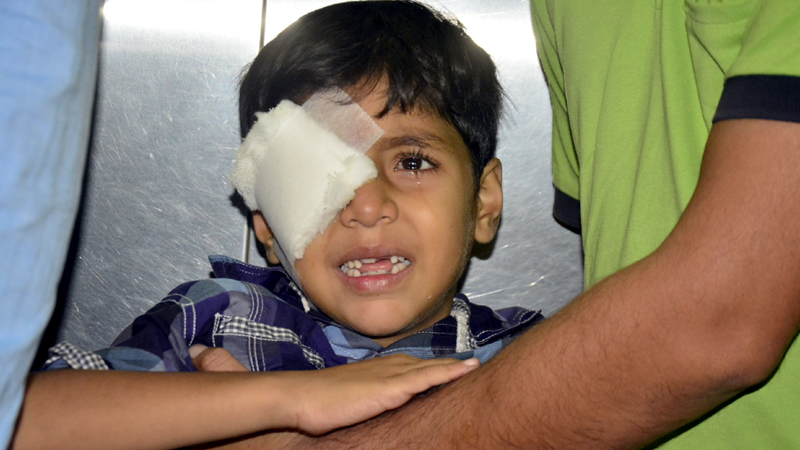 ਪਟਾਕਿਆਂ ਨੇ ਖੋਹੀ 20 ਲੋਕਾਂ ਦੀਆਂ ਅੱਖਾਂ ਦੀ ਰੌਸ਼ਨੀ