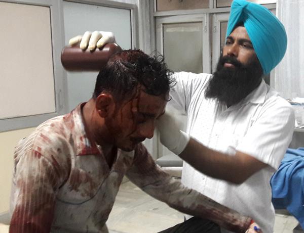 the driver of the car robbed and attacked 1 20 lakh rupees