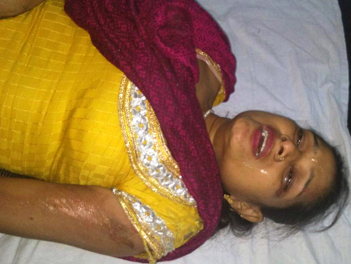 ਸਕੂਟਰੀ ਦੇ ਟਾਇਰ ਦਾ ਪਟਾਕਾ ਪੈਣ ਕਾਰਨ 2 ਔਰਤਾਂ ਜ਼ਖਮੀ