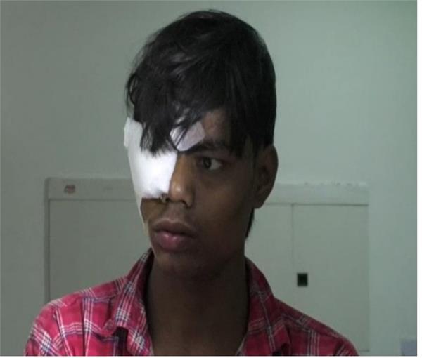 injured with firecrackers