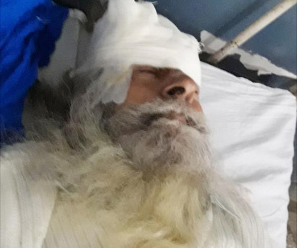 elderly injured due to a car accident