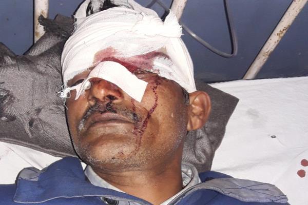 injured in a motorcycle whack