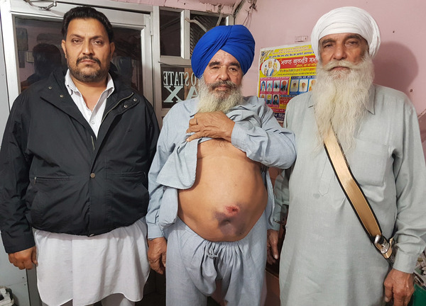 ਆਵਾਰਾ ਸਾਨ੍ਹ ਨੇ 70 ਸਾਲਾ ਬਜ਼ੁਰਗ ''ਤੇ ਕੀਤਾ ਹਮਲਾ