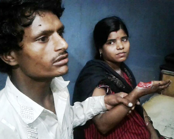 ਫੈਕਟਰੀ ਮਾਲਕ ਦੀ ਧੱਕੇਸ਼ਾਹੀ ਮਸ਼ੀਨ ''ਚ ਹੱਥ ਆਉਣ ਕਾਰਨ ਔਰਤ ਵਰਕਰ ਦਾ ਕੱਟਿਆ ਅੰਗੂਠਾ