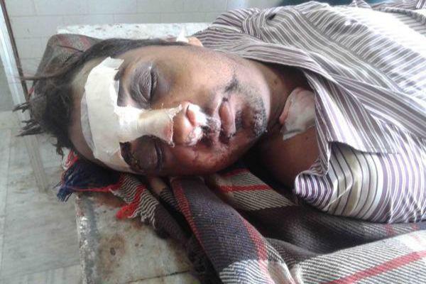 the death of the person injured in a road accident