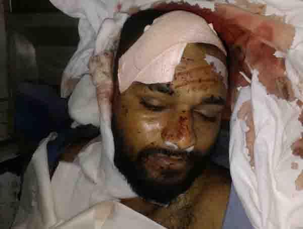 1 dead in road accident 1 dead