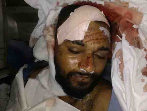 ਸੜਕ ਹਾਦਸੇ 'ਚ 1 ਦੀ ਮੌਤ ਤੇ 1 ਜ਼ਖਮੀ