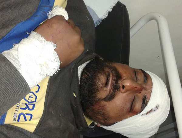 ਲੜ ਰਹੀਆਂ ਦੋ ਧਿਰਾਂ ਨੂੰ ਛੁਡਾਉਣ ਵਾਲੇ ਨੂੰ ਕੀਤਾ ਜ਼ਖਮੀ