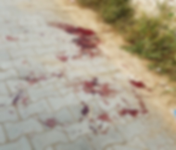 ਜਲੰਧਰ: ਜ਼ਮੀਨੀ ਵਿਵਾਦ ਦੇ ਚਲਦਿਆਂ ਦੋ ਧਿਰਾਂ ''ਚ ਹੋਈ ਫਾਇਰਿੰਗ, 3 ਲੋਕ ਜ਼ਖਮੀ (ਤਸਵੀਰਾਂ)