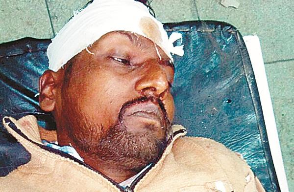 a motorcycle rider injured in a bus collision