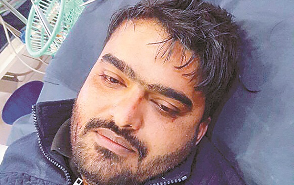 ਤੇਜ਼ਧਾਰ ਹਥਿਆਰਾਂ ਨਾਲ ਹਮਲਾ ਕਰਕੇ 8600 ਰੁਪਏ ਤੇ ਮੋਬਾਇਲ ਖੋਹਿਆ