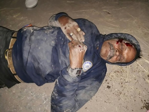 ਕਾਰ-ਐਕਟਿਵਾ ਦੀ ਟੱਕਰ ''ਚ 1 ਜ਼ਖਮੀ