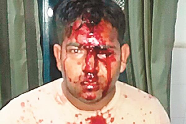 beating the person going to work