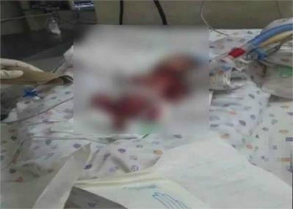 the hospital told that the cost of 50 lakhs