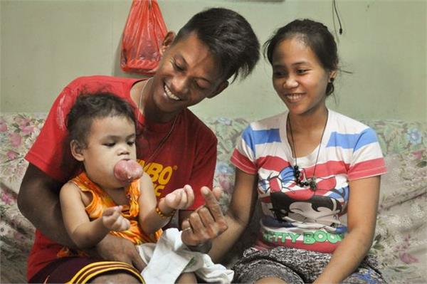 2 year old child has terrible illness  the family is waiting for a miracle