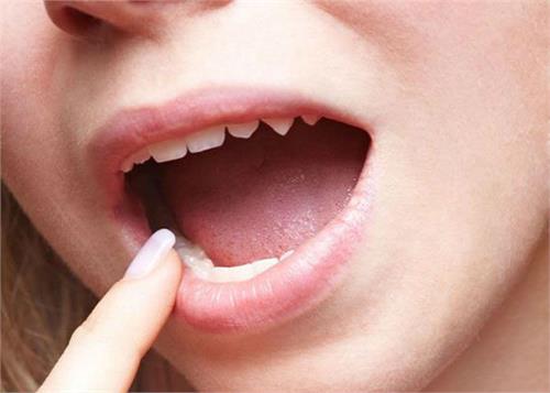 the easy way to clean born white coating on the tongue