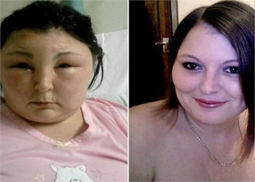 comes on the face is swelling daily work