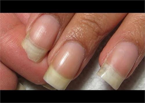 nails on the collapse of the measures