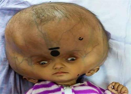 strange it was child s head due to illness