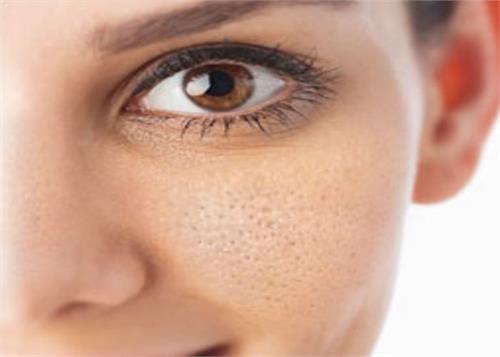 to get rid of open face of face follow these domestic ways