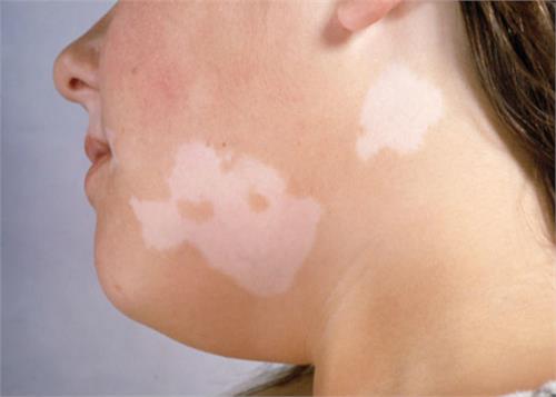 these easy ways to get rid of white rags