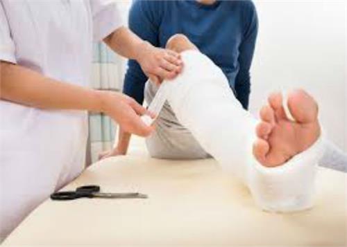 use this easy way to quickly connect a broken bone