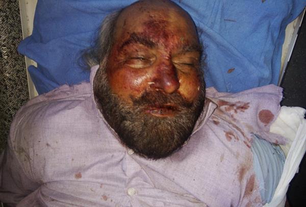 car and motorcycle collisions  1 death