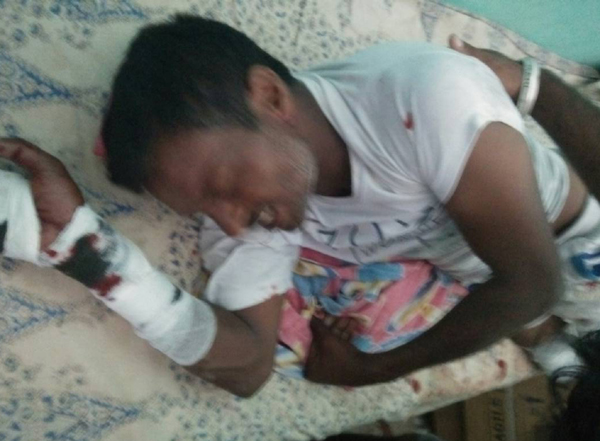 ਪਖਾਨਾ ਗਏ ਨੌਜਵਾਨ ''ਤੇ ਬਾਘ ਵੱਲੋਂ ਹਮਲਾ