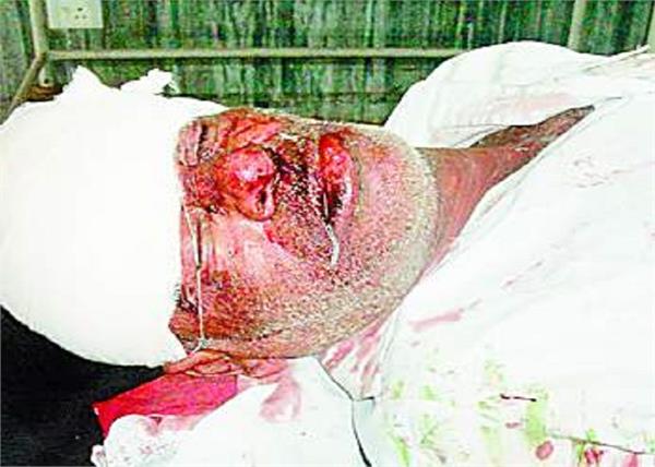 motorcyclist injured in a road accident